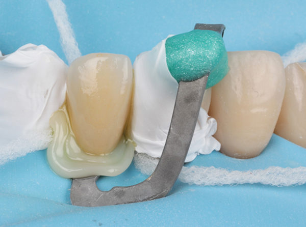 Biomimetic dentistry course info