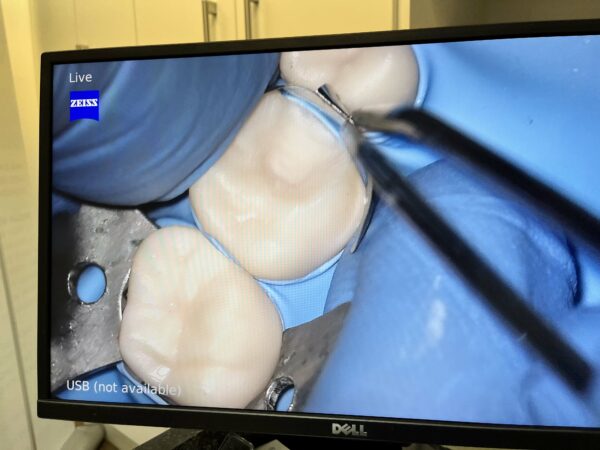 Biomimetic dentistry course info - Image 4