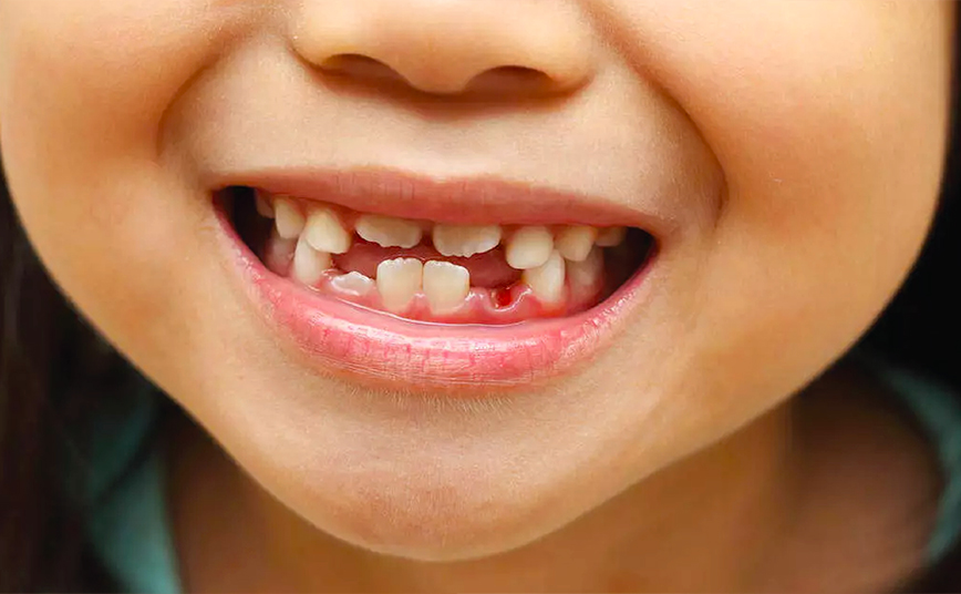 Paediatric dentistry course Nexus Dental